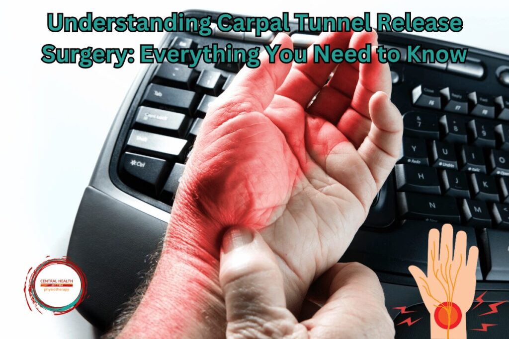 Understanding Carpal Tunnel Release Surgery: Everything You Need to Know