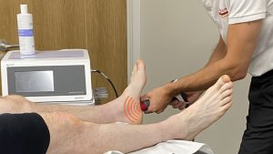 sports injury shockwave therapy