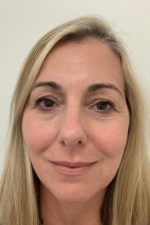 cathy barrett physiotherapist