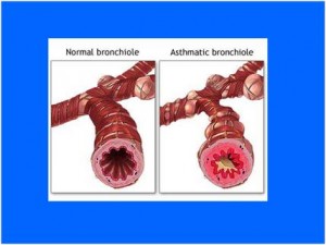 Bronchiole