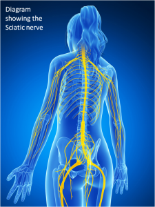 Diagram showing the sciatic nerve