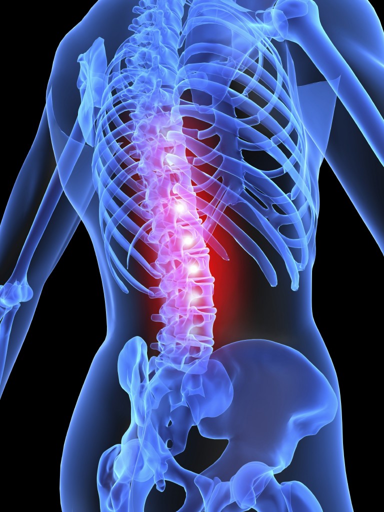 A 3D xray of a body showing the spine